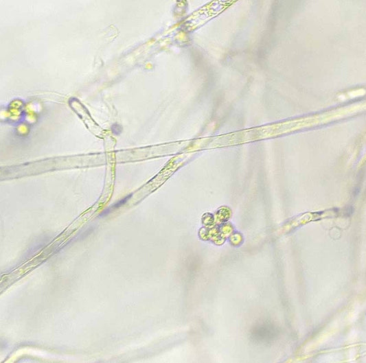 Crayfish plague (Aphanomyces astaci)