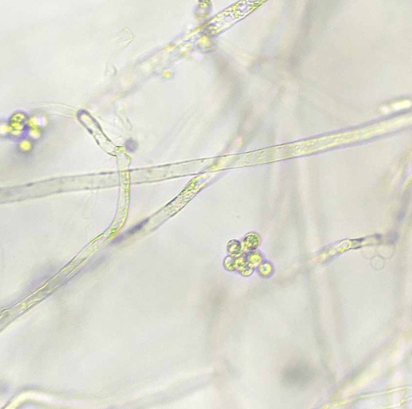 Crayfish plague (Aphanomyces astaci)